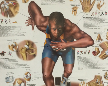 Planche anatomique Kiné du sport Juvignac